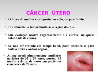 CÂNCER ÚTERO
    
        O útero da mulher é composto por colo, corpo e fundo.

    
        Inicialmente, o tumor limita-se à região do colo.

    
        Sua evolução ocorre vagarosamente e é curável na quase
        totalidade dos casos.

    
        Se não for tratado em tempo hábil, pode estender-se para
        todo o útero e outros órgãos.

        Atinge predominantemente mulheres
        na faixa de 35 a 50 anos; porém, há
        muitos relatos de casos em pacientes
        com cerca de 20 anos.
 