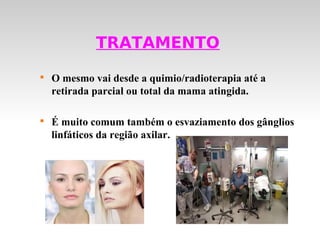 TRATAMENTO

    O mesmo vai desde a quimio/radioterapia até a
    retirada parcial ou total da mama atingida.


    É muito comum também o esvaziamento dos gânglios
    linfáticos da região axilar.
 