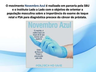 O movimento Novembro Azul é realizado em parceria pela SBU 
e o Instituto Lado a Lado com o objetivo de orientar a 
população masculina sobre a importância do exame de toque 
retal e PSA para diagnóstico precoce do câncer de próstata. 
. 
 