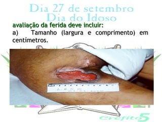 avaliação da ferida deve incluir:
a)     Tamanho (largura e comprimento) em
centímetros.
 