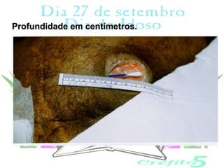 Profundidade em centímetros.
 