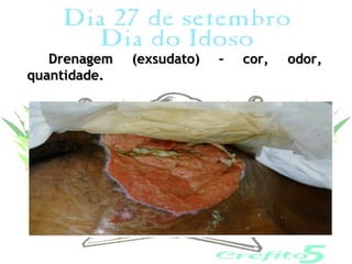 Drenagem   (exsudato)   –   cor,   odor,
quantidade.
 