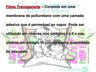 Filme Transparente – Consiste em uma

membrana de poliuretano com uma camada

adesiva que é permeável ao vapor. Pode ser

utilizado em úlceras nos estágios I e II e nas

úlceras em estágio III com pequena quantidade

de exsudato.
 
