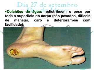 •Colchões de água: redistribuem o peso por
toda a superfície do corpo (são pesados, difíceis
de manejar, caro e deterioram-se com
facilidade);
 