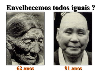 Envelhecemos todos iguais ?Envelhecemos todos iguais ?
62 anos62 anos 91 anos91 anos
 