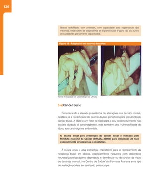 136
A busca ativa é uma estratégia importante para o rastreamento da
neoplasia bucal em idosos, especialmente naqueles com desordens
neuropsiquiátricas (como depressão e demência) ou distúrbios da visão
ou destreza manual. No Centro de Saúde Vila Formosa Mariana este tipo
de avaliação poderia ser realizado pela equipe.
5.4| Câncer bucal
Considerando a elevada prevalência de alterações nos tecidos moles,
destaca-se a necessidade de exames bucais periódicos para prevenção do
câncer bucal. A idade é um fator de risco para o seu desenvolvimento não
só pela duração da carcinogênese, mas também pela vulnerabilidade do
idoso aos carcinógenos ambientais.
Idosos reabilitados com próteses, sem capacidade para higienização das
mesmas, necessitam de dispositivos de higiene bucal (Figura 19), ou auxílio
de cuidadores previamente capacitados.
O exame anual para prevenção do câncer bucal é indicado pelo
Instituto Nacional do Câncer (BRASIL, 2008b) para indivíduos de risco
especialmente os tabagistas e alcoólatras.
Figura 19 - Adaptação em escovas dentárias
Fonte: Faculdade de Odontologia da UFMG
 