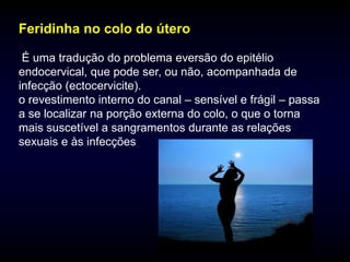Feridinha no colo do útero

 É uma tradução do problema eversão do epitélio
endocervical, que pode ser, ou não, acompanhada de
infecção (ectocervicite).
o revestimento interno do canal – sensível e frágil – passa
a se localizar na porção externa do colo, o que o torna
mais suscetível a sangramentos durante as relações
sexuais e às infecções
 