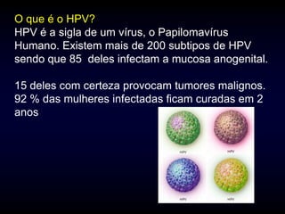 O que é o HPV?
HPV é a sigla de um vírus, o Papilomavírus
Humano. Existem mais de 200 subtipos de HPV
sendo que 85 deles infectam a mucosa anogenital.

15 deles com certeza provocam tumores malignos.
92 % das mulheres infectadas ficam curadas em 2
anos
 