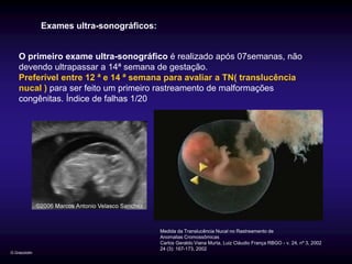 Exames ultra-sonográficos:


    O primeiro exame ultra-sonográfico é realizado após 07semanas, não
    devendo ultrapassar a 14ª semana de gestação.
    Preferível entre 12 ª e 14 ª semana para avaliar a TN( translucência
    nucal ) para ser feito um primeiro rastreamento de malformações
    congênitas. Índice de falhas 1/20




                                            Medida da Translucência Nucal no Rastreamento de
                                            Anomalias Cromossômicas
                                            Carlos Geraldo Viana Murta, Luiz Cláudio França RBGO - v. 24, nº 3, 2002
                                            24 (3): 167-173, 2002
G.Grazziotin
 