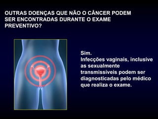 OUTRAS DOENÇAS QUE NÃO O CÂNCER PODEM
SER ENCONTRADAS DURANTE O EXAME
PREVENTIVO?




                      Sim.
                      Infecções vaginais, inclusive
                      as sexualmente
                      transmissíveis podem ser
                      diagnosticadas pelo médico
                      que realiza o exame.
 