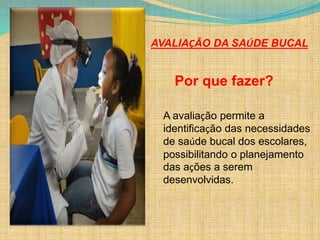 AVALIAÇÃO DA SAÚDE BUCAL 
Por que fazer? 
A avaliação permite a 
identificação das necessidades 
de saúde bucal dos escolares, 
possibilitando o planejamento 
das ações a serem 
desenvolvidas. 
 