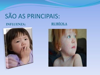 SÃO AS PRINCIPAIS: 
INFLUENZA: RUBÉOLA 
 