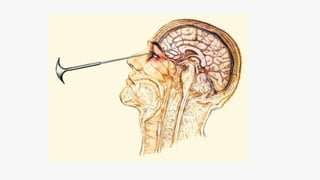 saude mental e historia do doente mental