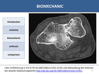 07/06/2016 1010
• Bibliographie
BIOMECHANIC
introduction
anatomy
biomechanic
arthrosis
comparison
J Der Unfallchirurg V 115 N 7R 10.1007/s00113-012-2178-z Die Behandlung der Arthrose
des distalen Radioulnargelenks http://dx.doi.org/10.1007/s00113-012-2178-z
 