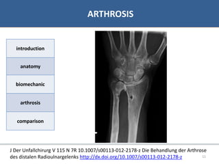 07/06/2016 1111
• Bibliographie
ARTHROSIS
introduction
anatomy
biomechanic
arthrosis
comparison
J Der Unfallchirurg V 115 N 7R 10.1007/s00113-012-2178-z Die Behandlung der Arthrose
des distalen Radioulnargelenks http://dx.doi.org/10.1007/s00113-012-2178-z
 