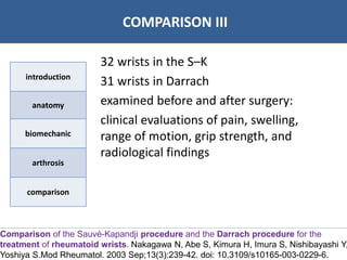 07/06/2016 2626
• Bibliographie
COMPARISON III
introduction
anatomy
biomechanic
arthrosis
comparison
32 wrists in the S–K
31 wrists in Darrach
examined before and after surgery:
clinical evaluations of pain, swelling,
range of motion, grip strength, and
radiological findings
Comparison of the Sauvé-Kapandji procedure and the Darrach procedure for the
treatment of rheumatoid wrists. Nakagawa N, Abe S, Kimura H, Imura S, Nishibayashi Y,
Yoshiya S.Mod Rheumatol. 2003 Sep;13(3):239-42. doi: 10.3109/s10165-003-0229-6.
 