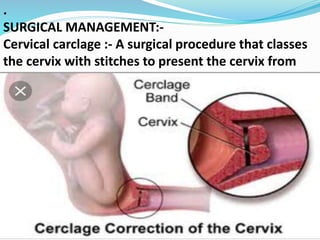 .
SURGICAL MANAGEMENT:-
Cervical carclage :- A surgical procedure that classes
the cervix with stitches to present the cervix from
opening and abnormal dilatation
 