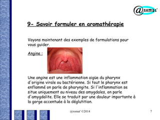 9- Savoir formuler en aromathérapie
Voyons maintenant des exemples de formulations pour
vous guider.
Angine :

Une angine est une inflammation aigüe du pharynx
d'origine virale ou bactérienne. Si tout le pharynx est
enflammé on parle de pharyngite. Si l'inflammation se
situe uniquement au niveau des amygdales, on parle
d'amygdalite. Elle se traduit par une douleur importante à
la gorge accentuée à la déglutition.
@romat' ©2014

7

 