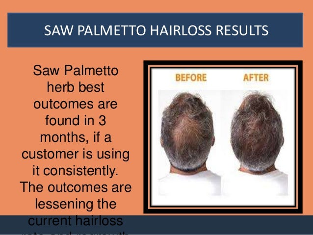 Saw Palmetto Miracle Results
