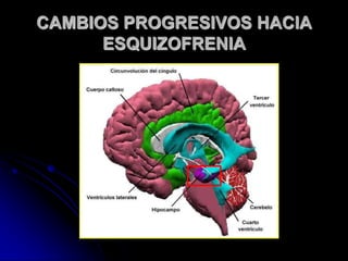 CAMBIOS PROGRESIVOS HACIA ESQUIZOFRENIA