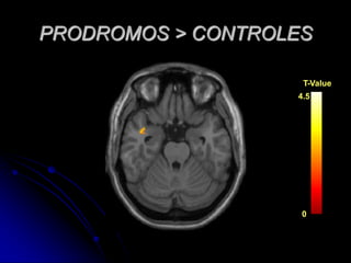 PRODROMOS > CONTROLEST-ValueT-Value4.54.500