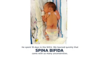 He spent 18 days in the NICU. We learned quickly that
came with so many uncertainities.
SPINA BIFIDA
 
