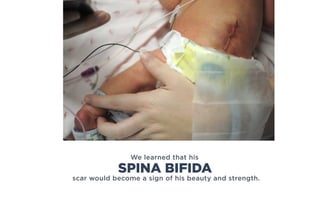 We learned that his
scar would become a sign of his beauty and strength.
SPINA BIFIDA
 