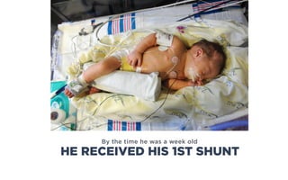 By the time he was a week old
HE RECEIVED HIS 1ST SHUNT
 