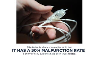 This device is what my son relies on to live.
8 of my son’s 12 surgeries have been shunt related.
IT HAS A 50% MALFUNCTION RATE
 