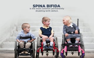 is the most common permanently
disabling birth defect.
SPINA BIFIDA
 