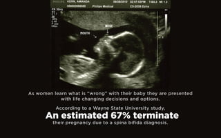 As women learn what is “wrong” with their baby they are presented
with life changing decisions and options.
their pregnancy due to a spina bifida diagnosis.
According to a Wayne State University study,
An estimated 67% terminate
 