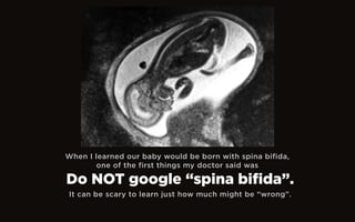 When I learned our baby would be born with spina bifida,
one of the first things my doctor said was
It can be scary to learn just how much might be “wrong”.
Do NOT google “spina bifida”.
 