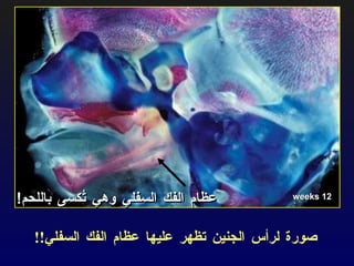 عظام الفك السفلي وهي تُكسى باللحم ! صورة لرأس الجنين تظهر عليها عظام الفك السفلي !! 12 weeks 