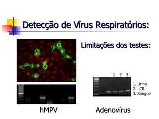 Detecção de Vírus Respiratórios: Adenovírus hMPV Limitações dos testes: 1  2  3 1. Urina 2. LCR 3. Sangue 
