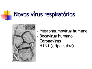 Novos vírus respiratórios - Metapneumovirus humano - Bocavirus humano Coronavirus H1N1 (gripe suína)... 