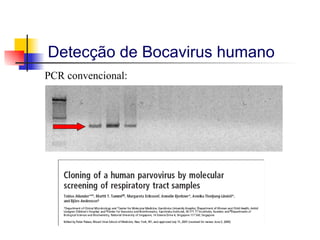 Detecção de Bocavirus humano PCR convencional: 