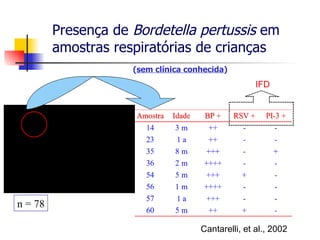 Presença de  Bordetella pertussis  em amostras respiratórias de crianças n = 78 Cantarelli, et al., 2002 IFD ( sem clínica conhecida ) 