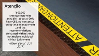 Coledocolitíase Peroperatória
Atenção
“600.000
cholecystectomies
annually, about 8-20%
have CBS, no consensus
on optimal management
, and the
recommendations
contained within should
not replace individual
clinical judgement .”
William E et al GUT,
2017.
 
