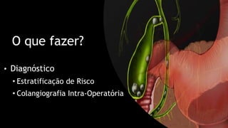 O que fazer?
• Diagnóstico
• Estratificação de Risco
• Colangiografia Intra-Operatória
 