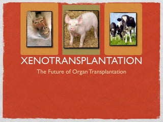 XENOTRANSPLANTATION
  The Future of Organ Transplantation
 