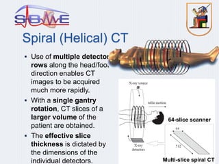 medical equipment lec 6 CT scan | PPTX