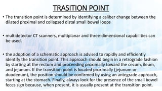 Transitional Point Bowel RADIOLOGIC ANATOMY OF SMALL INTESTINE AND INTRODUCTION TO SMALL BOWEL ...