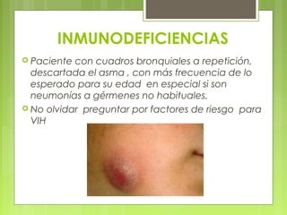 INMUNODEFICIENCIAS
 Paciente con cuadros bronquiales a repetición,
descartada el asma , con más frecuencia de lo
esperado para su edad en especial si son
neumonías a gérmenes no habituales.
 No olvidar preguntar por factores de riesgo para
VIH
 