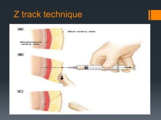 Spontaneous Bacterial peritonitis