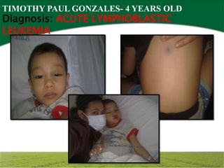 TIMOTHY PAUL GONZALES- 4 YEARS OLD
Diagnosis: ACUTE LYMPHOBLASTIC
LEUKEMIA
 