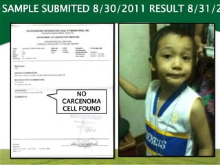 SAMPLE SUBMITED 8/30/2011 RESULT 8/31/2




              NO
          CARCENOMA
          CELL FOUND
 