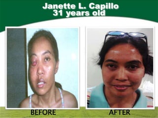 Janette L. Capillo
    31 years old




BEFORE           AFTER
 