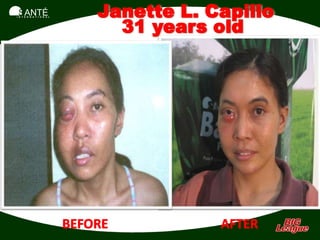 SANTÉ
I N T E R N A T I O N A L
 