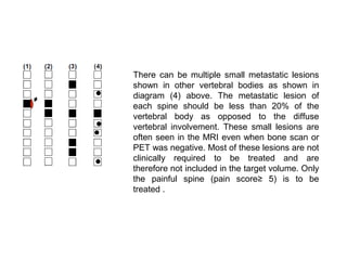 There can be multiple small metastatic lesions
shown in other vertebral bodies as shown in
diagram (4) above. The metastatic lesion of
each spine should be less than 20% of the
vertebral body as opposed to the diffuse
vertebral involvement. These small lesions are
often seen in the MRI even when bone scan or
PET was negative. Most of these lesions are not
clinically required to be treated and are
therefore not included in the target volume. Only
the painful spine (pain score≥ 5) is to be
treated .
 