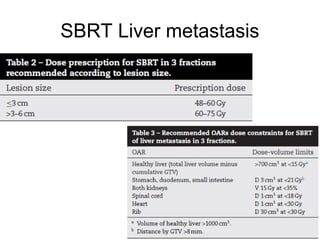 SBRT Liver metastasis
 